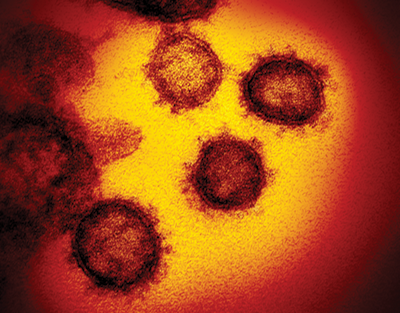 An electron microscope image of SARS-CoV-2, the virus that causes COVID-19 (Photograph: NIAID).