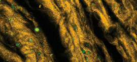 collagen fibers (yellow) and fibrochondrocytes (green) in the tissue engineered meniscus