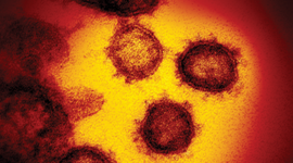 electron microscope image of SARS-CoV-2, the virus that causes COVID-19 (Photograph: NIAID).