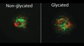tumor spheroid in glycated versus non-glycated collagen