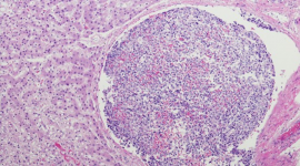 liver cells image