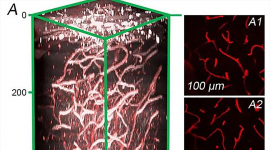 Cerebral vasculature imaged by 3-photon microscopy in a living mouse