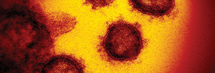 An electron microscope image of SARS-CoV-2, the virus that causes COVID-19