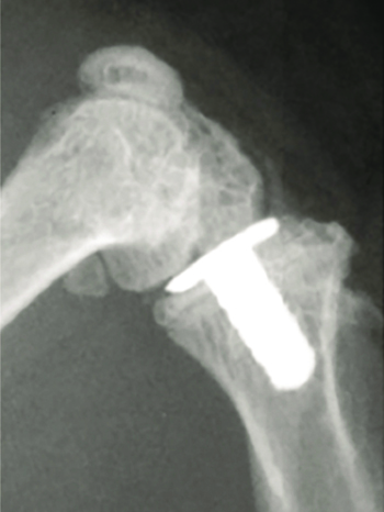 A titanium knee replacement for a mouse w
